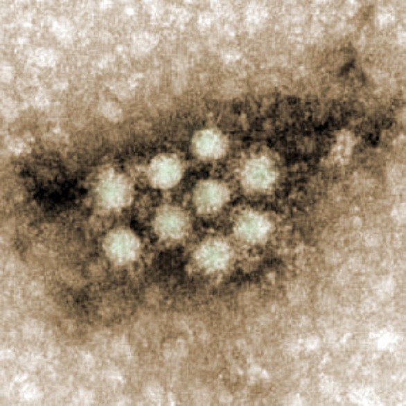 Parvovirus umano